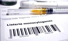 allerta alimentare rischio listeria